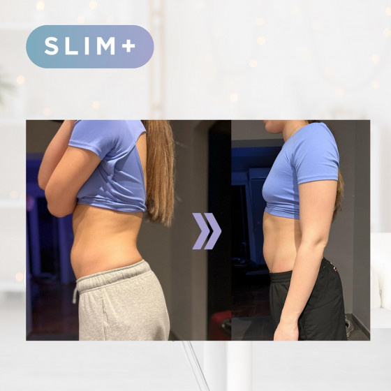 Le pack SLIM+ by Winback Le pack SLIM+ by Winback