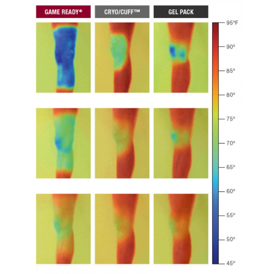 Thermographie Cryothérapie compressive Game Ready - Pack Professionnel - thermographie IR